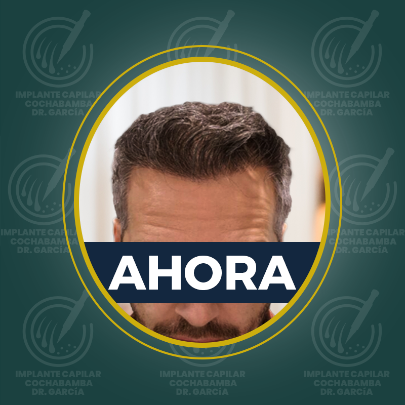 undefined - Después