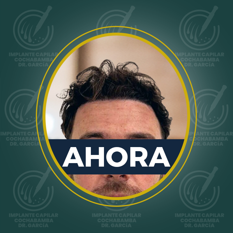 undefined - Después