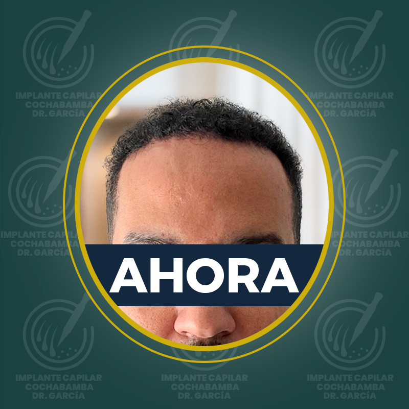 undefined - Después