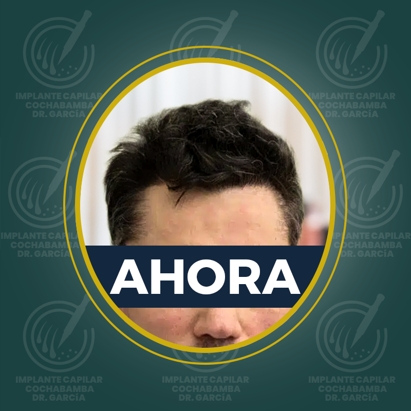 undefined - Después