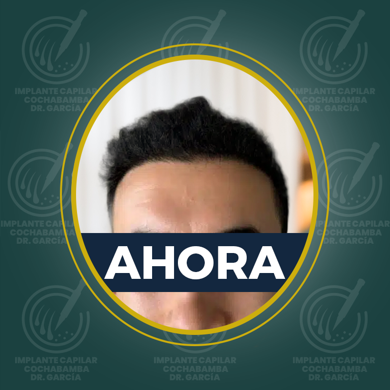 undefined - Después