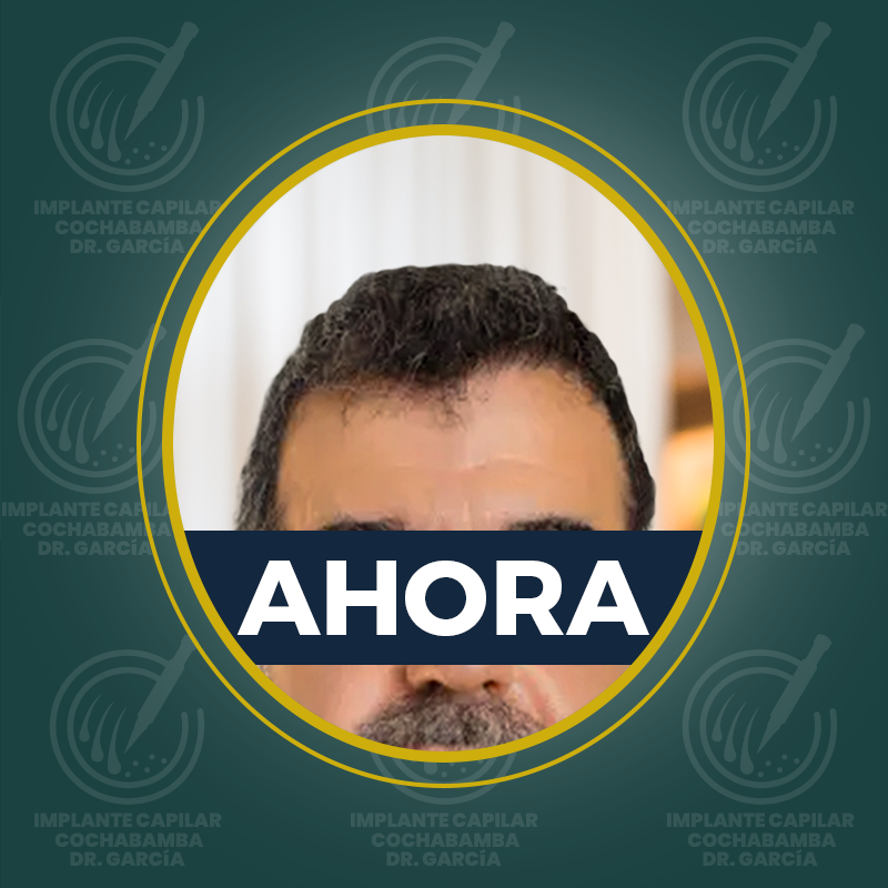 undefined - Después