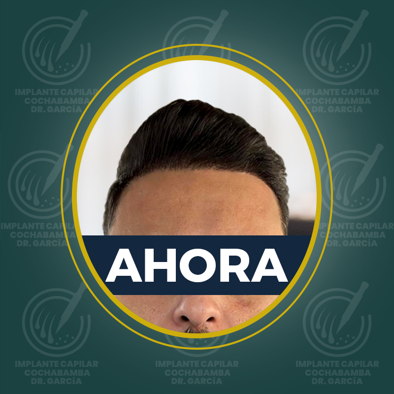 undefined - Después