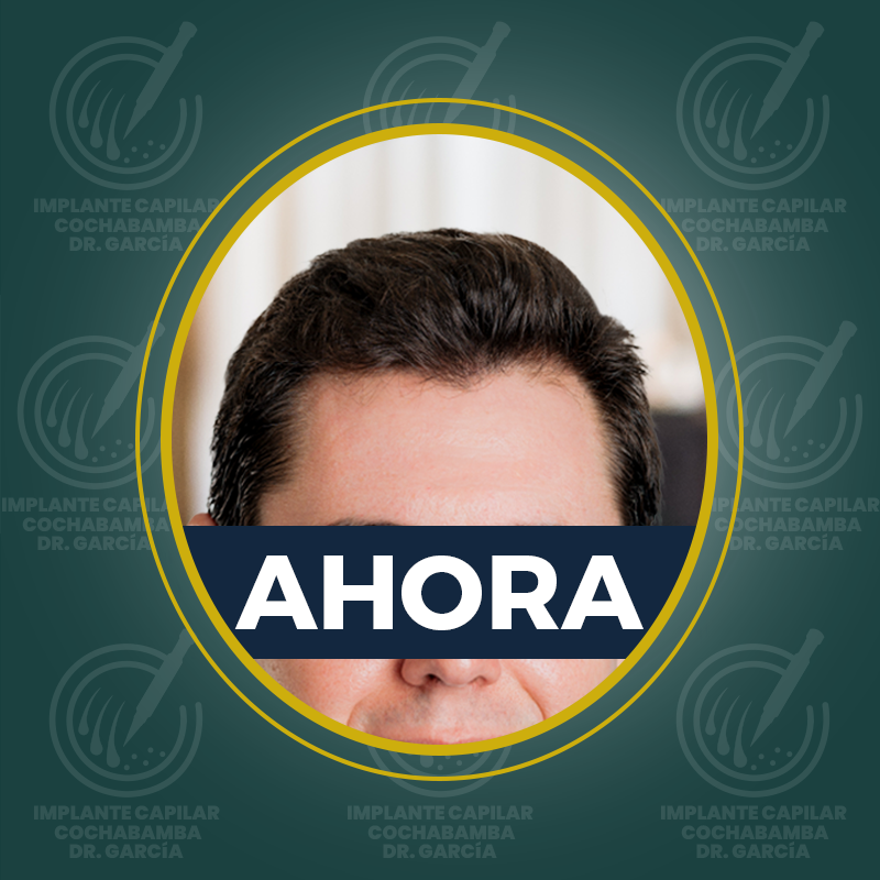 undefined - Después