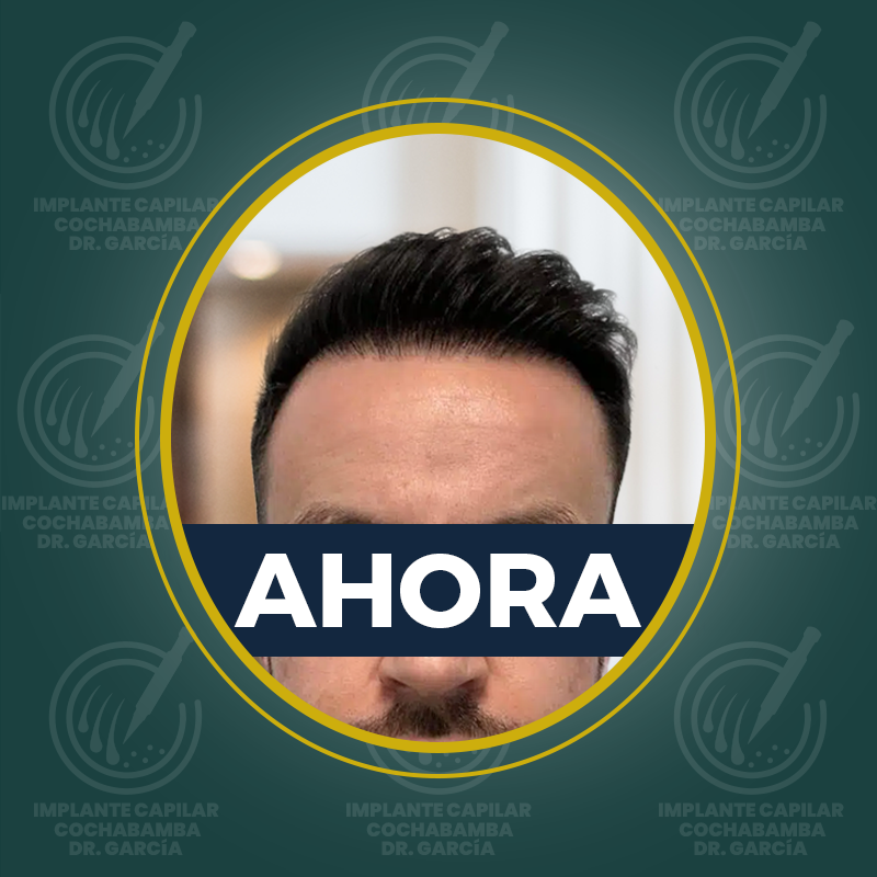 undefined - Después