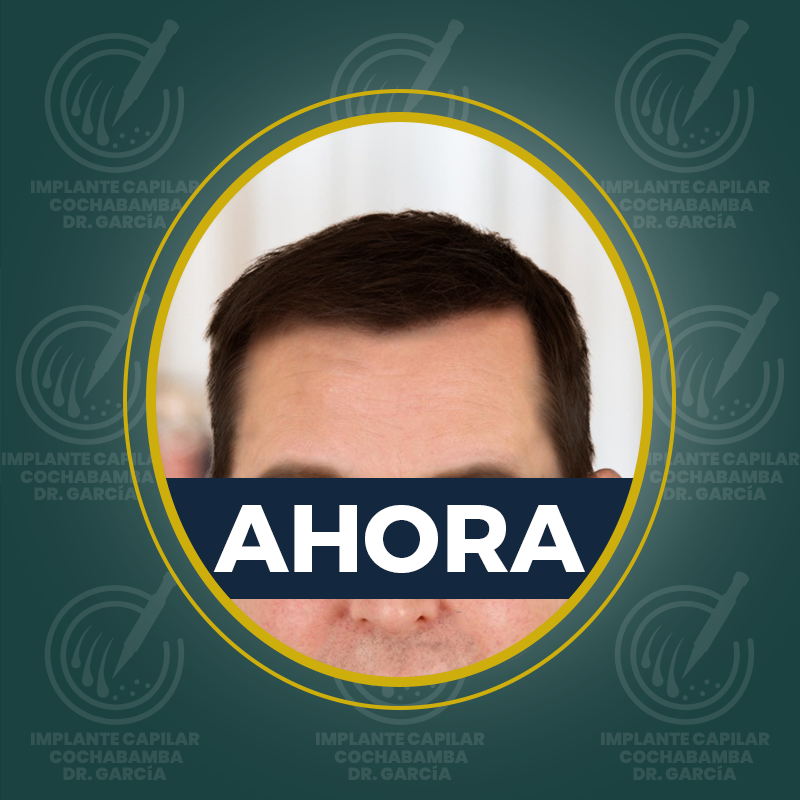 undefined - Después