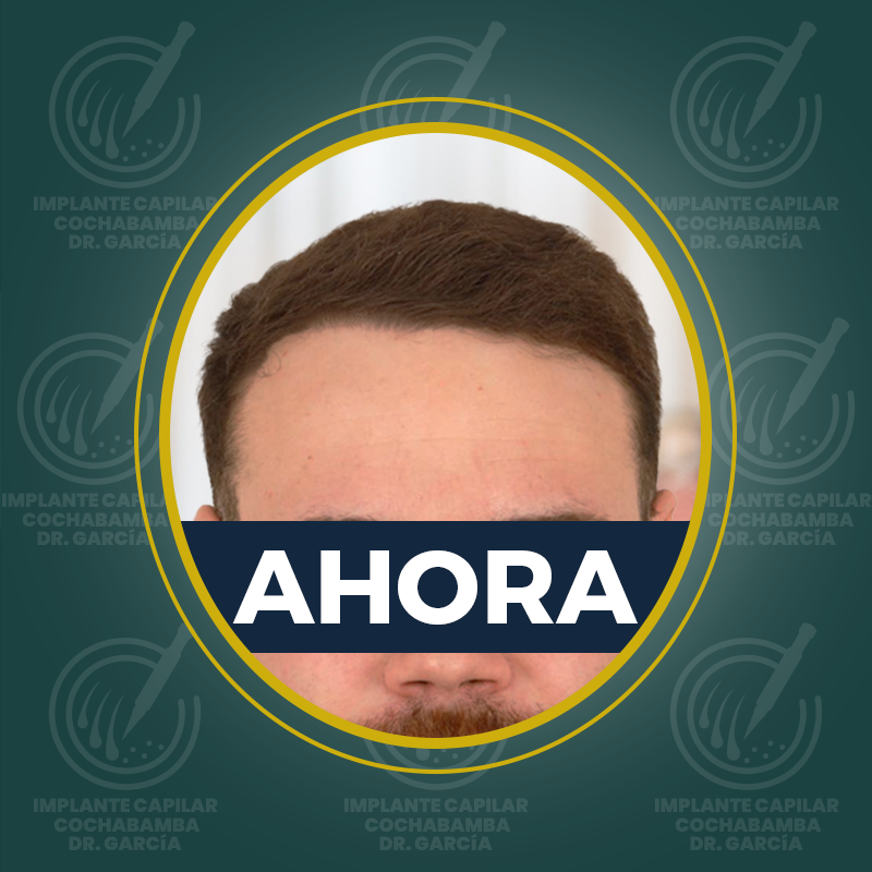 undefined - Después