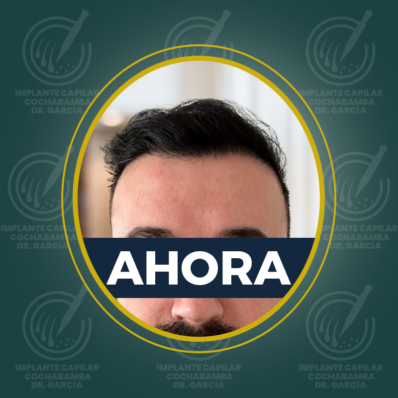 undefined - Después