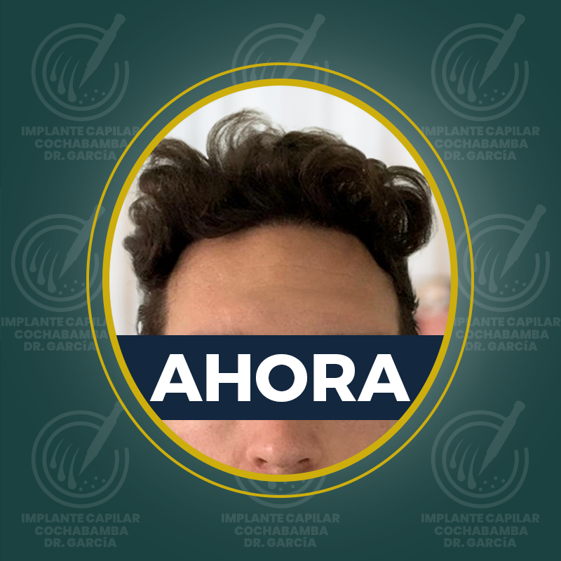 undefined - Después