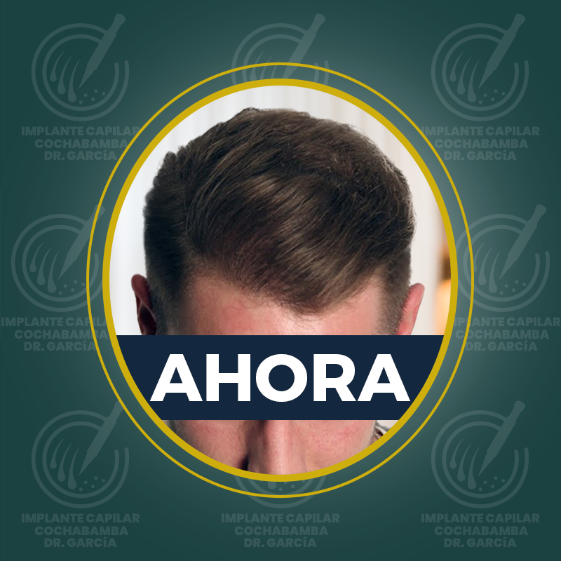 undefined - Después