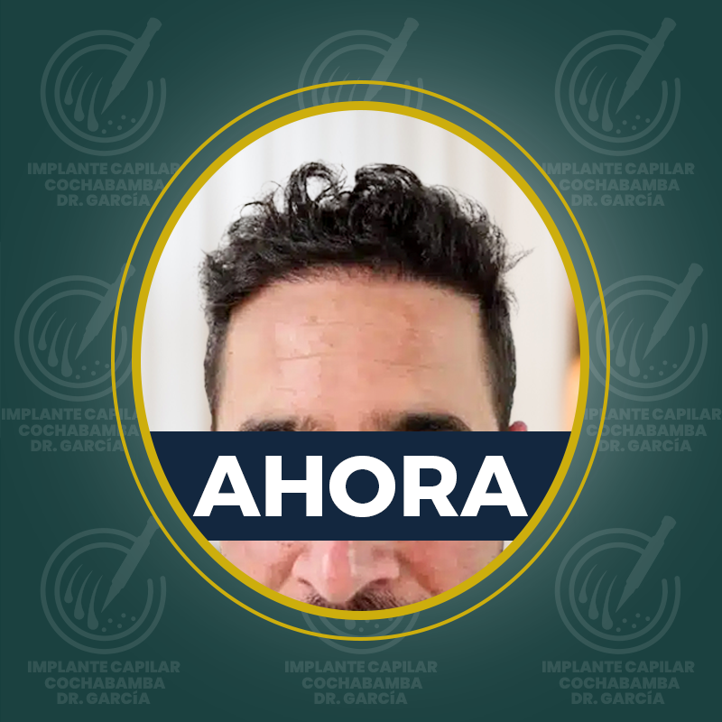 undefined - Después