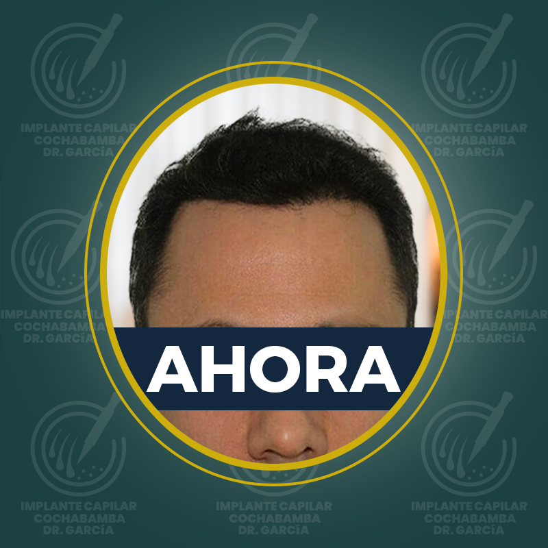 undefined - Después