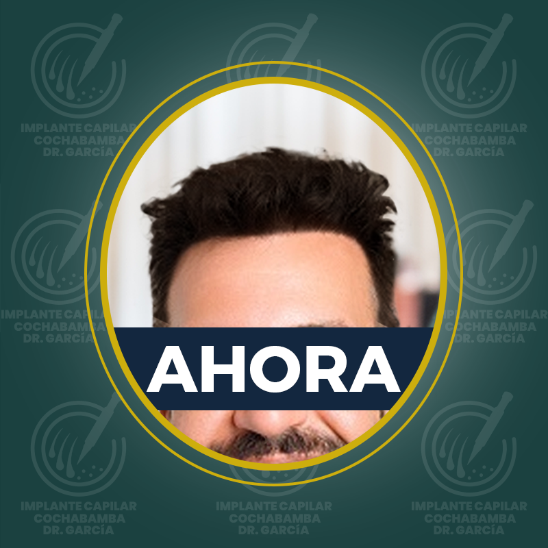 undefined - Después