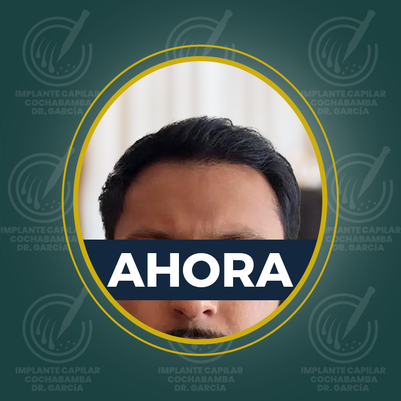 undefined - Después