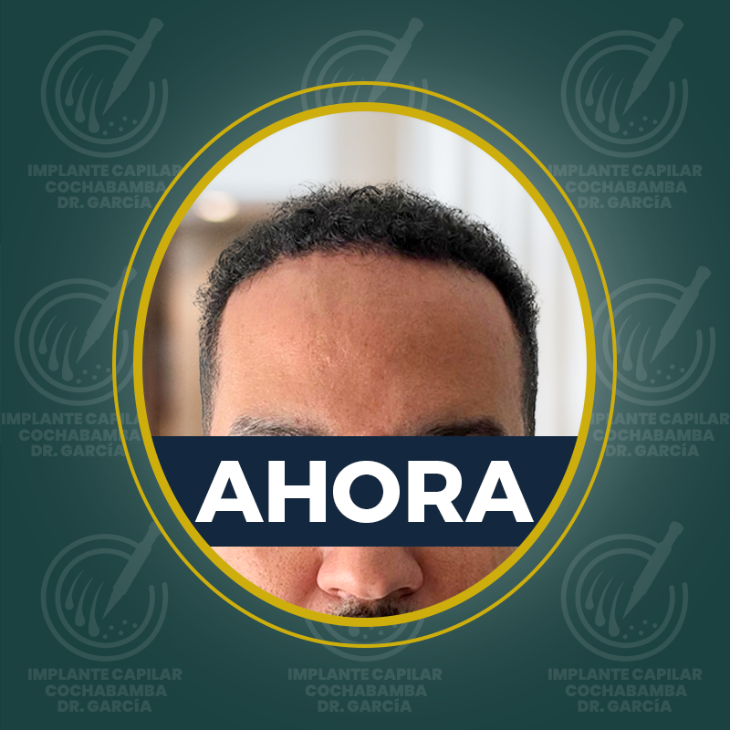 undefined - Después