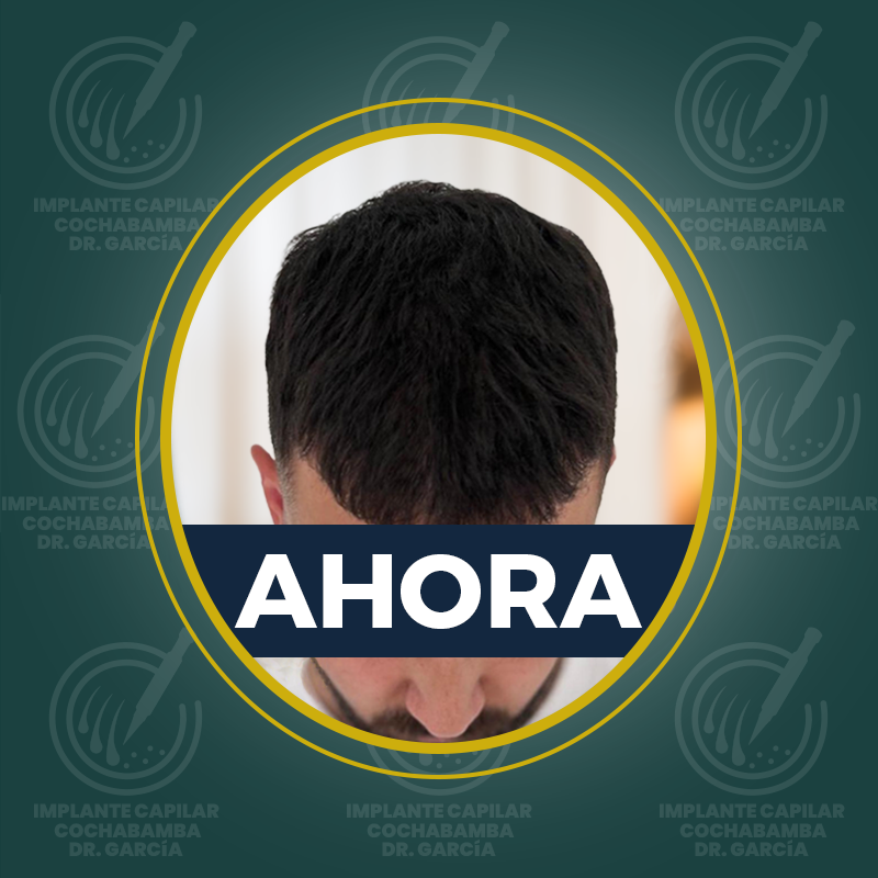 undefined - Después